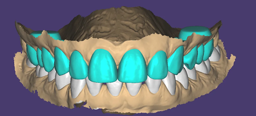 CadCam و ExoCad - دبي - +971 56 977 6755