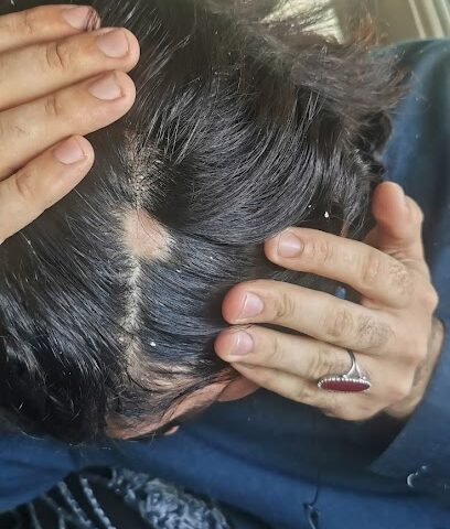 دكتور أحسن ، دكتوراه في الطب ، ABHRS (الولايات المتحدة) جراح زراعة الشعر أبو ظبي دبي الإمارات العربية المتحدة - أبو ظبي - +971 50 129 8697